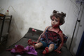 シリア北東部のドゥマ（Douma）の仮設の病院で治療を受ける少女（2014年9月24日撮影）。(c)AFP/ABD DOUMANY