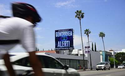 米国の性感染症、昨年の症例数が過去最高の約230万件 