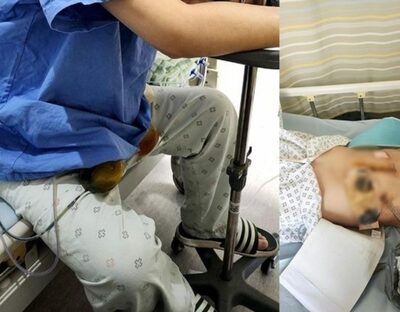 「夫が盲腸手術の末、人工肛門に」妻が激怒の投稿…韓国・病院は責任回避の姿勢