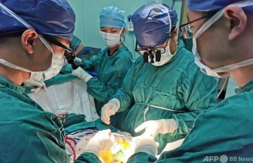 まひ患者が「脳-コンピューター接続装置」で運動能力を回復 中国