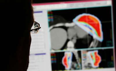 内側から腫瘍を散らす「クラスター爆弾」、イスラエル