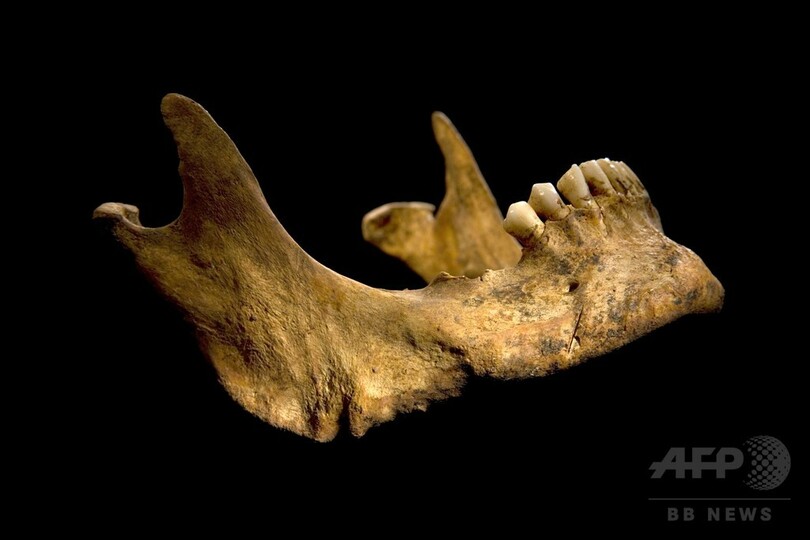 リチャード3世の「凄惨な死」、遺骨から明らかに