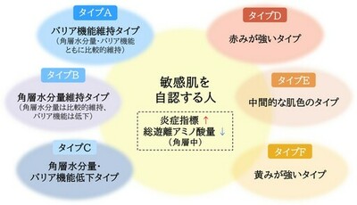 敏感肌には多様な肌状態が存在することを明らかに　角層の炎症状態・アミノ酸量・肌色特性の解析から、複数の敏感肌タイプの存在を確認