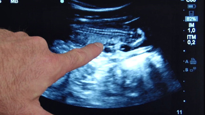 フランス初のパンダ妊娠、双子と判明 4～5日に出産予定