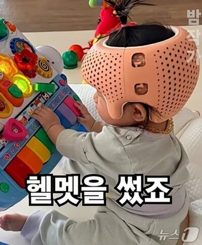 300万ウォンの「頭蓋矯正ヘルメット」に賛否…韓国・芸能人の使用公表で議論再燃