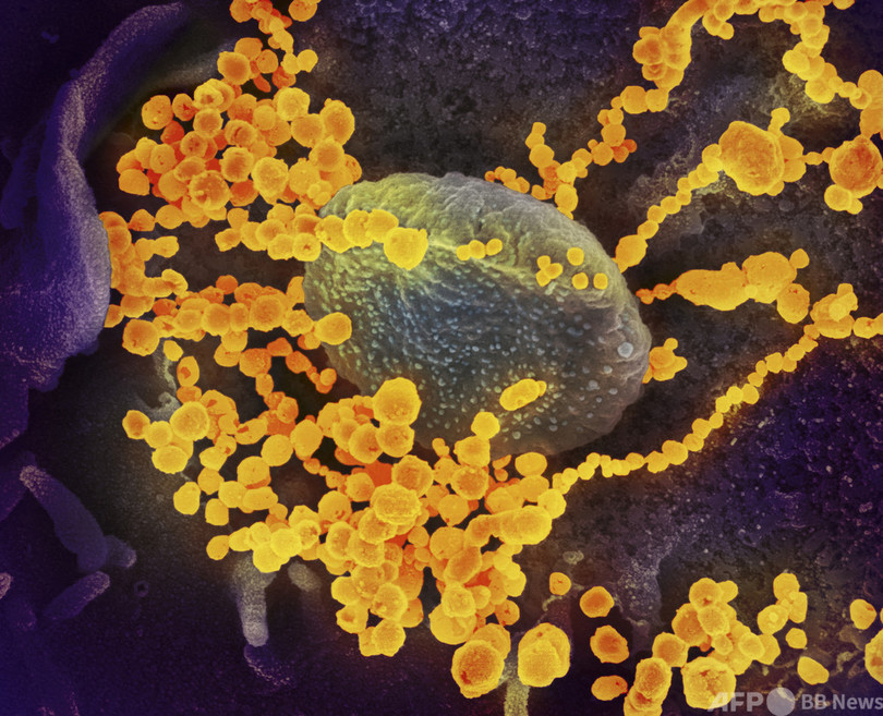 新型コロナ「研究所流出説」容認へ、フェイスブックが方針転換