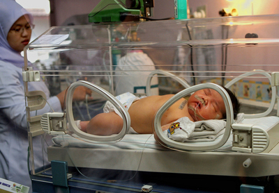 インドネシアで体重6.9キロの赤ちゃん誕生
