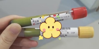 中国深セン市在住の男性 酒浸りの生活で血液が緑色に