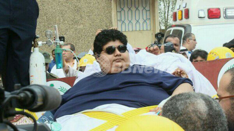 体重600キロ超のサウジ男性、フォークリフトで病院に搬送