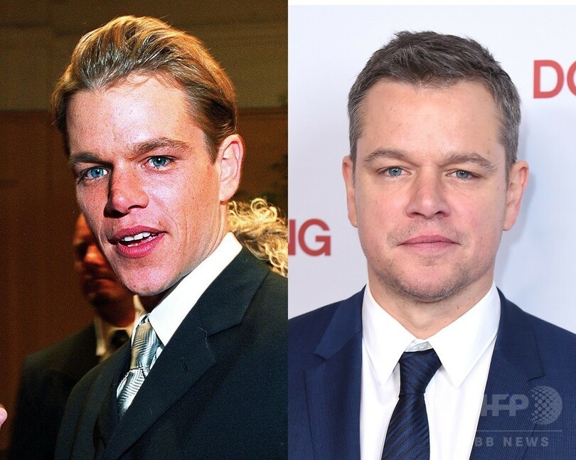 【写真特集】海外男性セレブのビフォーアフター