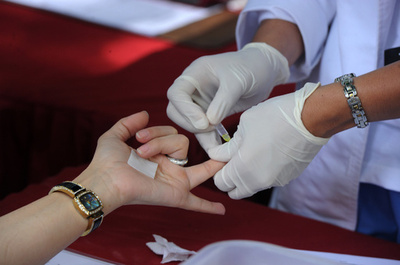 血液1滴で膵臓がん診断、新技術開発 研究