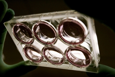 米科学者、ES細胞使った臨床試験の認可申請 視力障害治療で