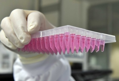 高精度「塩基エディター」、遺伝子治療の大きな一歩に 研究