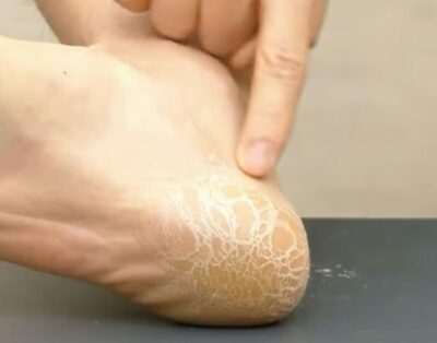 “頑固な角質が取れた！”効果PR→実は米粒・のり・薄力粉による偽装だった…韓国通販4社