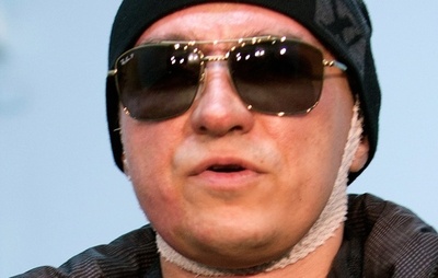 ボリショイ・バレエ芸術監督、襲撃事件後初めて劇場に戻る