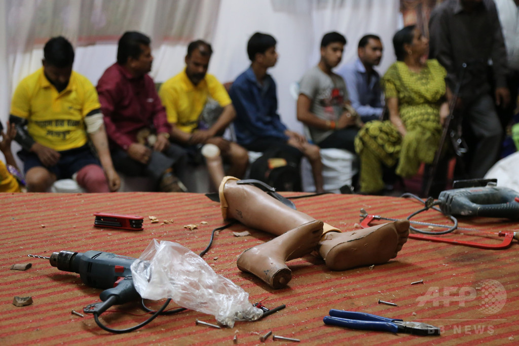 切断した患者の脚を枕代わりに… 医師2人停職処分、インド 切断した患者の脚を枕代わりに… 医師2人停職処分、インド