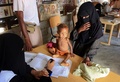 イエメン・ハッジャの国内避難民向けキャンプの医療施設で健診を受ける乳児（2021年12月21日撮影、資料写真）。(c)ESSA AHMED / AFP