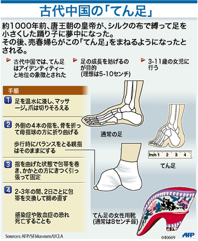 【図解】「てん足」の起源と手順