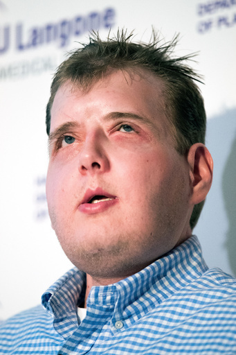 顔面移植手術から1年、「日常」取り戻した元消防団員の米男性