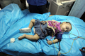 リビア・トリポリ（Tripoli）の病院で治療を受ける乳児。リビア政府が行った取材ツアーで撮影（2011年6月5日撮影）。(c)AFP