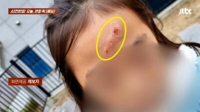 エレベーター天井から構造物落下…韓国・小1が顔に大けが、でも業者は誠意なし「固定せず置いただけ」