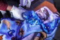 シリア北西部バブアルハワで、がれきの下から救出され治療を受ける子ども（2023年2月6日撮影）。(c)OMAR HAJ KADOUR / AFP