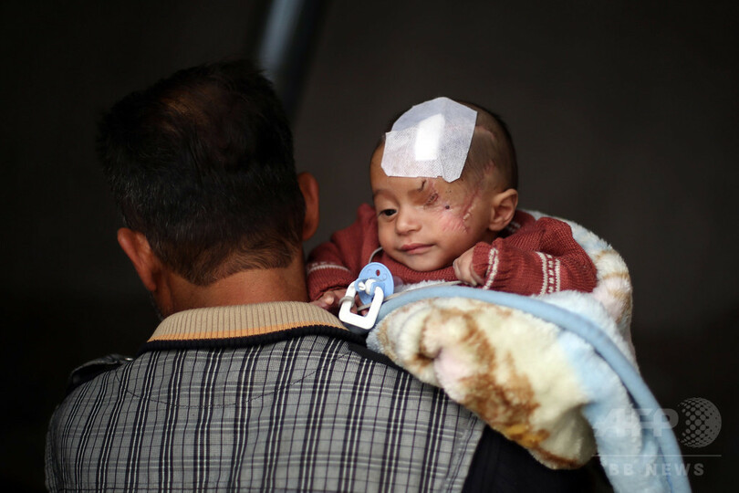 シリア空爆で片目失った赤ちゃん、トルコに脱出 大統領が出迎え