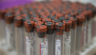 米でポリオ似の脊髄疾患増加 保健当局が警戒