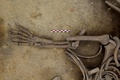 仏東部のアルザス地方で見つかった人骨。負傷の痕が確認できる（2016年6月7日提供）。(c)AFP/INRAP / Michel Christen