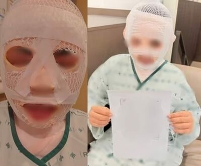 韓国人男性、タイ人の恋人の顔に「熱湯」という暴挙…タイで報道・動機は「嫉妬」