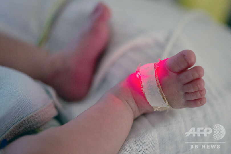 オランダの不妊治療医、17人の子の父親と発覚 自分の精子使う