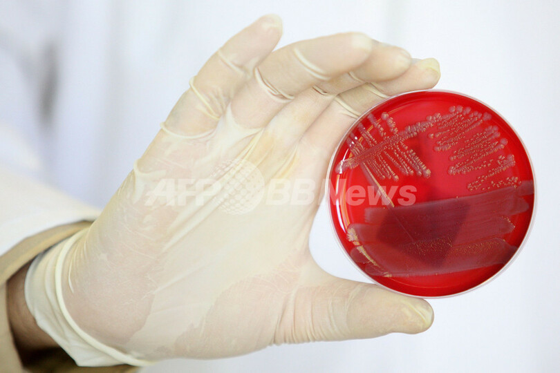 欧州で感染拡大の大腸菌O104、新種か