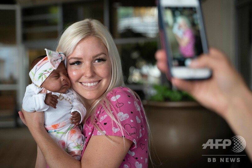 世界最小、245グラムで生まれた赤ちゃん 元気に退院 米カリフォルニア