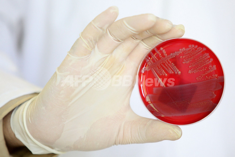欧州で感染拡大の大腸菌O104、新種か 欧州で感染拡大の大腸菌O104、新種か