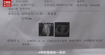 肋骨4本を折りながら命を助ける 中国