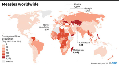 世界の1〜7月はしか感染者数、昨年同期の3倍近くに WHO