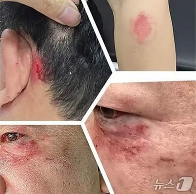 記者に暴行、歯2本折る…韓国・与党議員の“側近”男性が事務所で襲撃