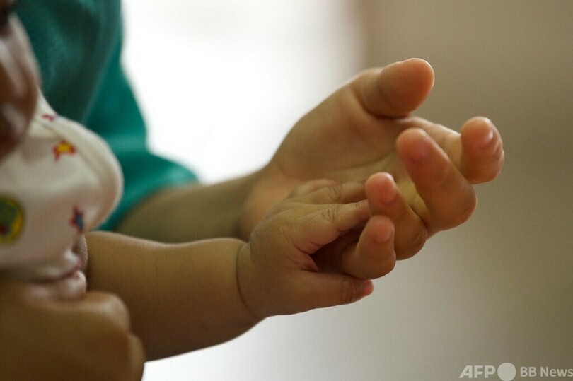 伊政府、難病の女児に国籍付与 英医師らは治療中止の意向