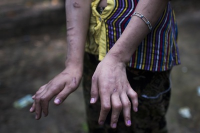 子どもに対する性的虐待件数、今年は前年比4割増 ミャンマー