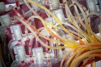 生後16か月の女児がHIVに感染、未検査の血液を輸血 ロシア