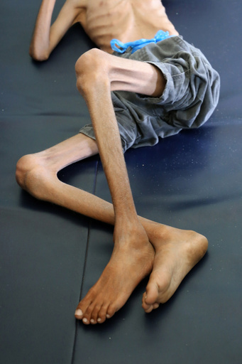 「苦しむ男の子」