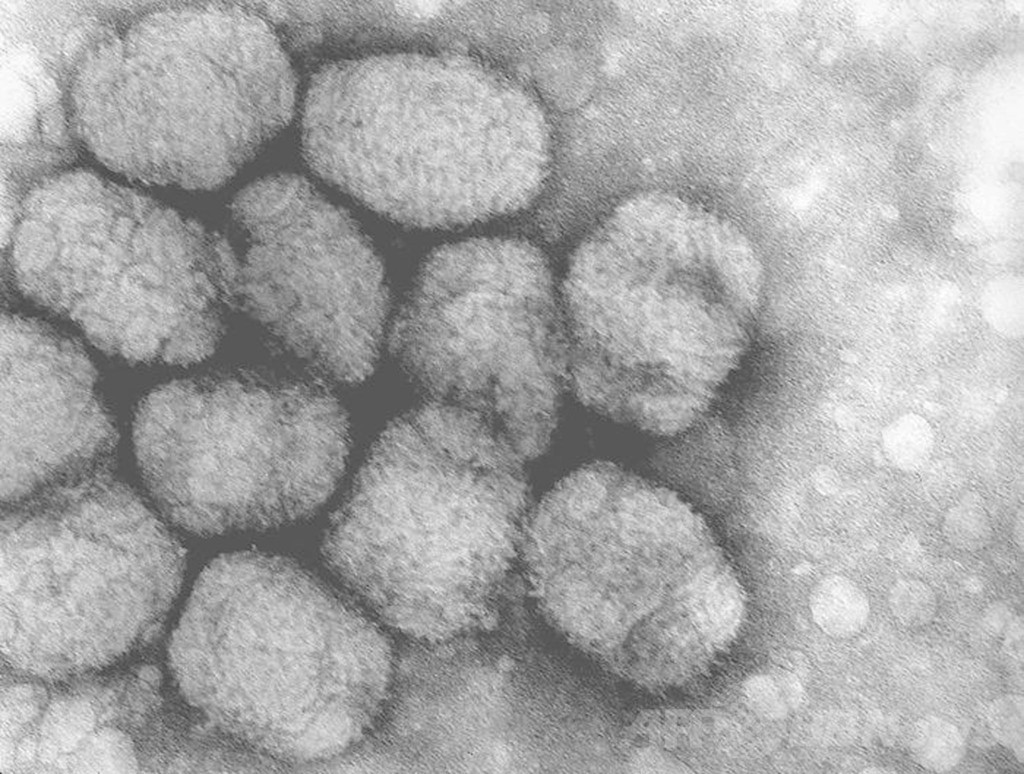 天然痘ウイルス入りの薬瓶、米政府施設から見つかる 天然痘ウイルス入りの薬瓶、米政府施設から見つかる