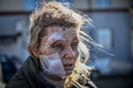 ウクライナ東部チュグエフで、爆撃で負傷した女性（2022年2月24日撮影）。(c) Aris Messinis / AFP