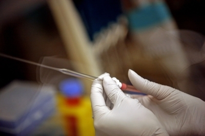 iPS細胞から人間の肝臓作成に成功、横浜市大