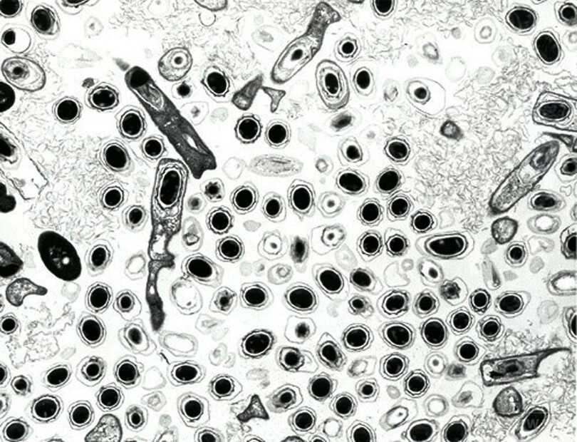 ロシア極北の炭疽集団発生、21人の感染確認