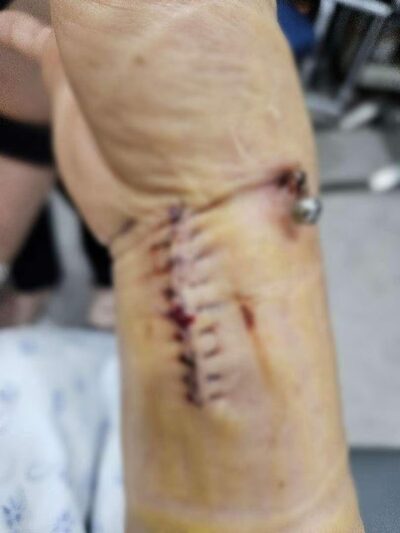 ソウル地下鉄駅、聴覚障害の母親が暴行され手首骨折…加害者逃走、警察捜査が及び腰