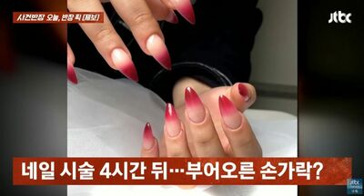 リアルなAI画像で「虚偽の腫れ」捏造…韓国・外国人女性の“ネイル詐欺”が波紋