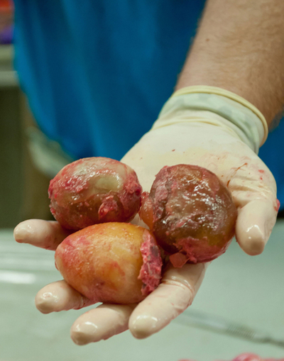 87個の卵を抱えた巨大ニシキヘビを捕獲、米フロリダ州