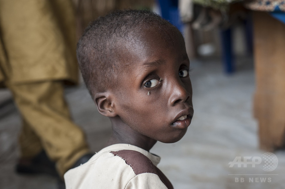 子どもたちに深刻な栄養失調 ボコ ハラムによる もう一つの悲劇 写真10枚 国際ニュース Afpbb News