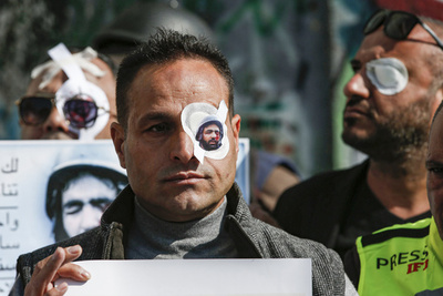 取材中のパレスチナ人記者が片目失う、眼帯姿のジャーナリストら抗議デモ